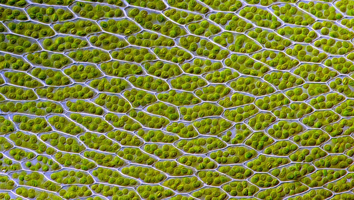 Live leaf cells of the moss Bryum capillare, showing abundant chloroplasts (green spherical bodies) and their accumulated starch granules (Des Callaghan/Wikimedia Commons)