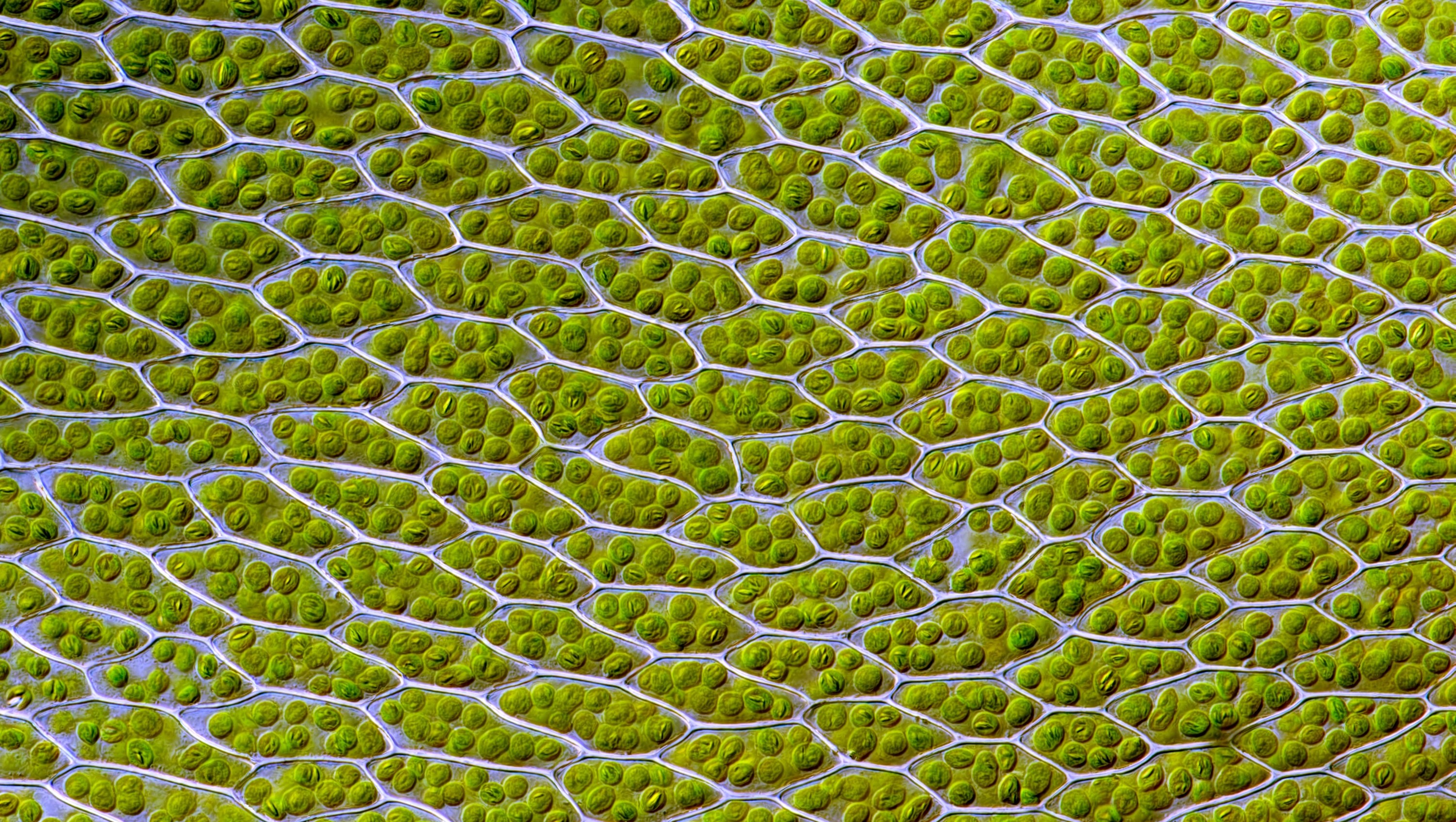 Live leaf cells of the moss Bryum capillare, showing abundant chloroplasts (green spherical bodies) and their accumulated starch granules (Des Callaghan/Wikimedia Commons)