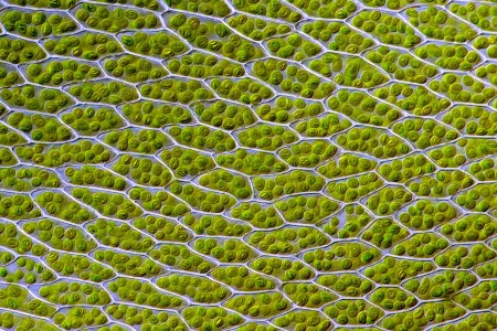Live leaf cells of the moss Bryum capillare, showing abundant chloroplasts (green spherical bodies) and their accumulated starch granules (Des Callaghan/Wikimedia Commons)