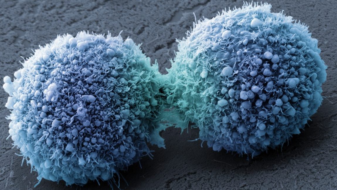 Pancreatic cancer cells completing cell division. (Visuals Unlimited, Inc./Dr. Stanley Flegler)