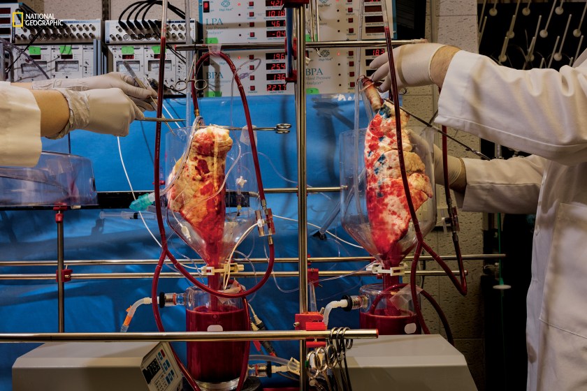 Human blood filters through pig lungs in the lab of Lars Burdorf at the University of Maryland School of Medicine. Thousands of people die every year for lack of transplantable human organs. Scientists are experimenting with CRISPR to rid pig organs of viruses that harm humans. Pig organs have already been successfully transplanted into primates. (Greg Girard/National Geographic)
