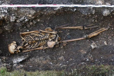 Skeleton missing left foot and ankle with prosthetic implant at Hemmaberg, Austria. (Austrian Archaeology Institute/Josef Eitler/AFP/Getty)