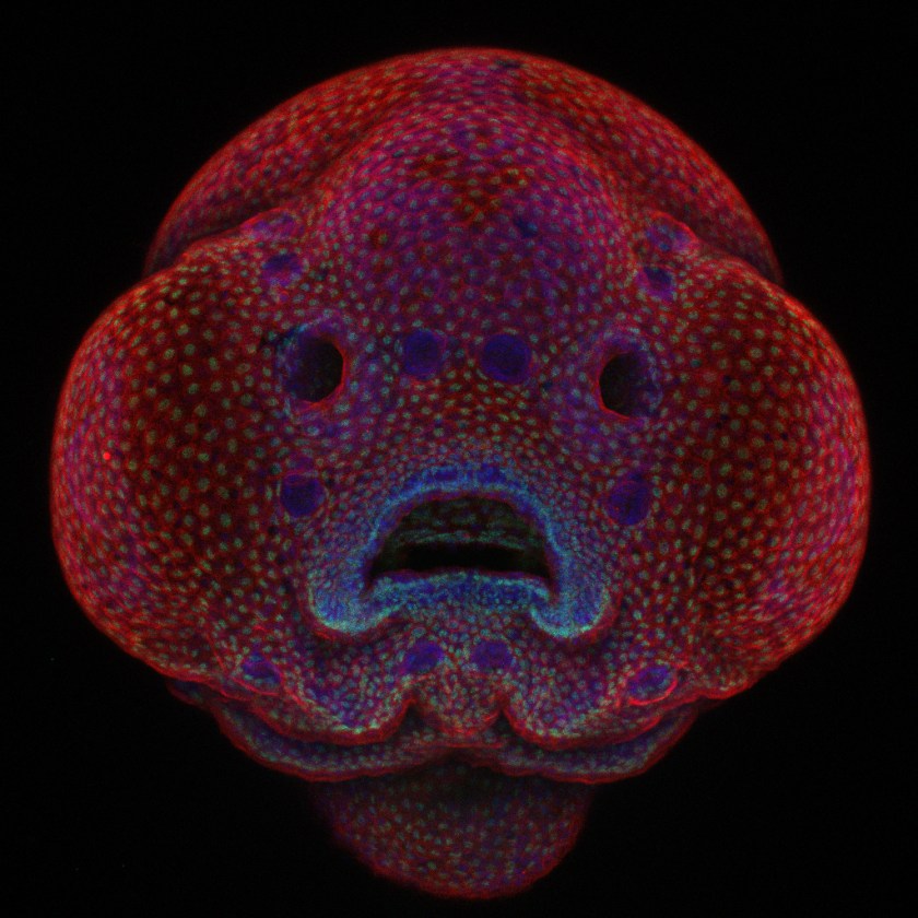 Four-day-old zebrafish embryo (Dr. Oscar Ruiz)