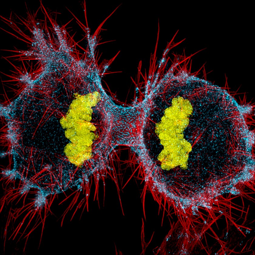 Human HeLa cell undergoing cell division (Dr. Dylan Burnette)