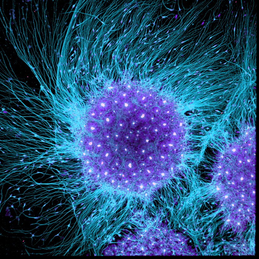 Human neural rosette primordial brain cells, differentiated from embryonic stem cells (Dr. Gist F. Croft, Lauren Pietilla, Stephanie Tse, Dr. Szilvia Galgoczi, Maria Fenner, Dr. Ali H. Brivanlou)