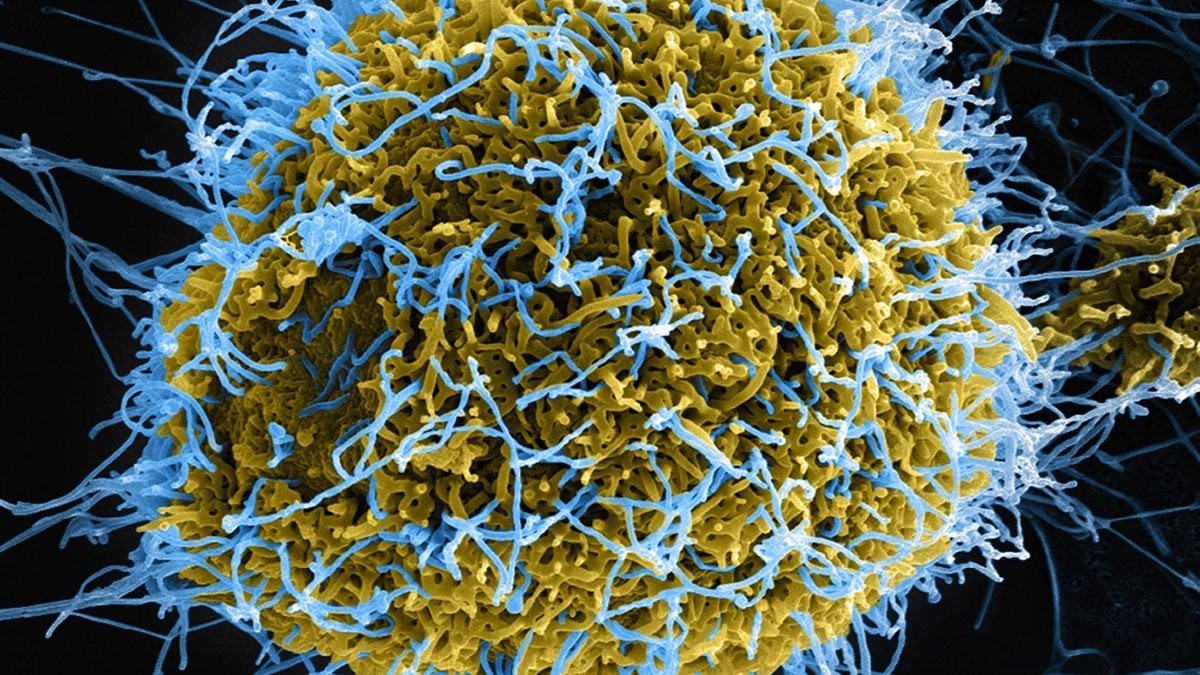 Filamentous Ebola virus particles, colored blue, budding from a chronically-infected VERO E6 cell, colored yellow (Getty Images)