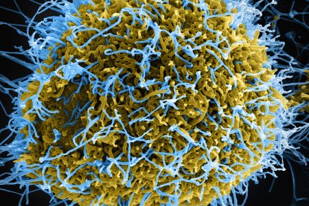 Filamentous Ebola virus particles, colored blue, budding from a chronically-infected VERO E6 cell, colored yellow (Getty Images)