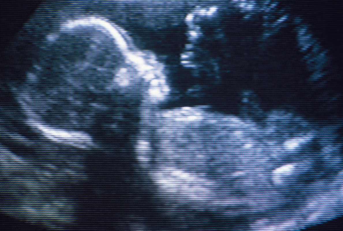 Ultrasound of baby (Getty Images)