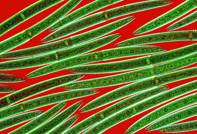 USA: Feature Rates Apply Mandatory Credit: Photo by SpikeWalker/RPS/Bournemouth/REX/Shutterstock (6047461r) A group of one-celled freshwater algae. Microscope images of creatures, vitamins, crystals, UK - Sep 2016 *Full story: http://www.rexfeatures.com/nanolink/srsr These incredible microscopic images of creatures, vitamins, crystals and even a fetus are to be recognised with an award from the Royal Photographic Society. Spike Walker has been fascinated by photomicrography since he got his first microscope just after the conclusion of the Second World War, when he was about 12-years-old. Now his life's passion is to be recognised with a Scientific Imaging Award from one of the world's oldest and prestigious photographic societies. The accolade is given to an individual for a body of photography which promotes public knowledge and understanding. The RPS said Spike's decades of work and immeasurable contribution to the field make him the perfect recipient.