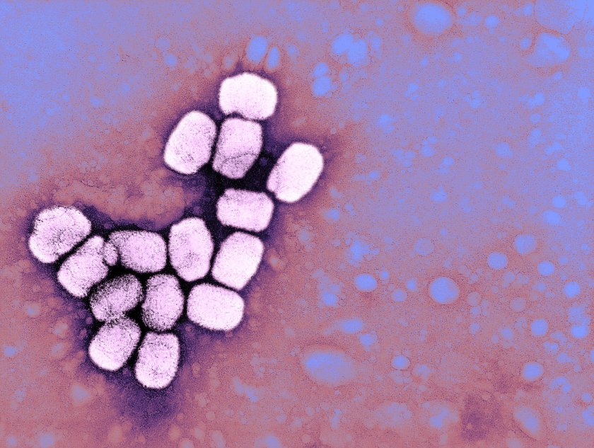 Microscopic image of the Smallpox Virus (BSIP/UIG via Getty Images)