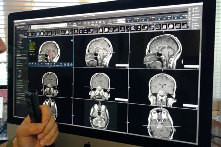 IBM demos AI and imaging at RSNA 2016, world's largest annual gathering of radiologists in Chicago. (IBM Watson Health)