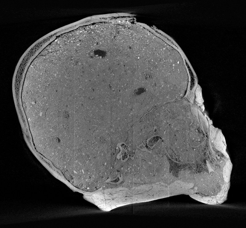 Sagittal micro-CT image showing variation in the thickness of the skull bones and a broken tooth with abscess in the upper jaw (Trustees of the Natural History Museum)