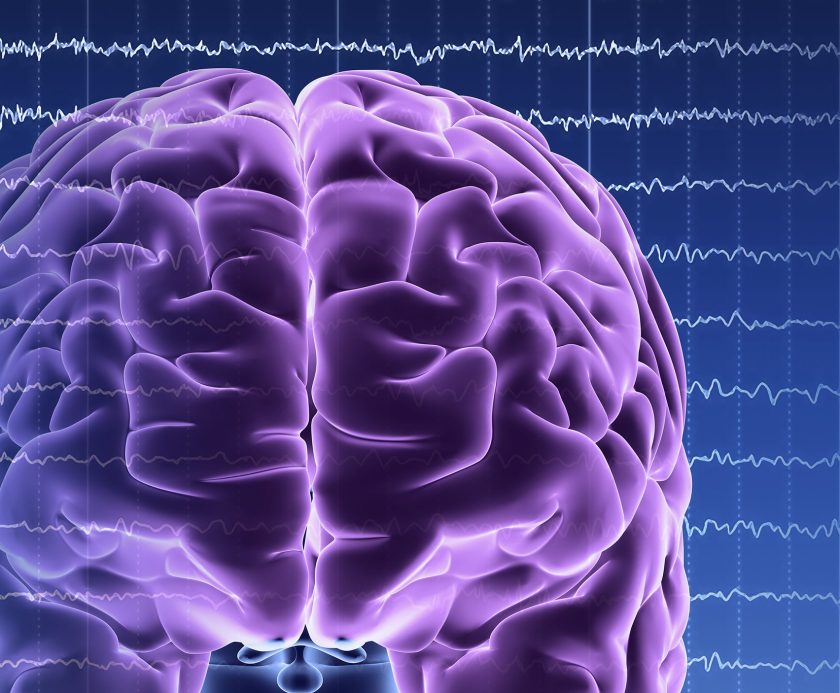 Brain activity. Computer artwork of EEG (electroencephalogram) traces superimposed over a brain illustration. An EEG records the brain's activity.