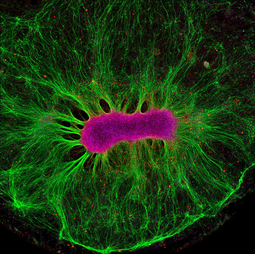 Brain-on-a-chip (Collin Edington and Iris Lee, © Massachusetts Institute of Technology)