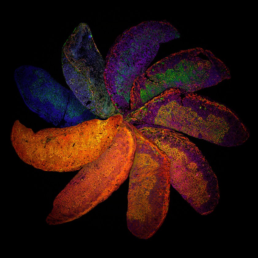 The Placenta Rainbow (Suchita Nadkarni, William Harvey Research Institute, Queen Mary University of London)