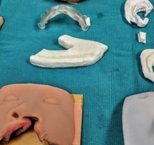 Three-dimensional models based on real human cases like these allow hands-on experience for surgeons in training. (Michigan Medicine)