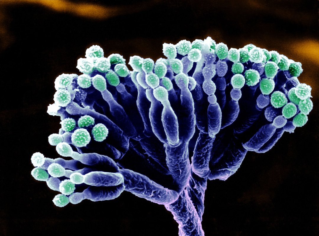 Microscopic image of Penicillium with spores