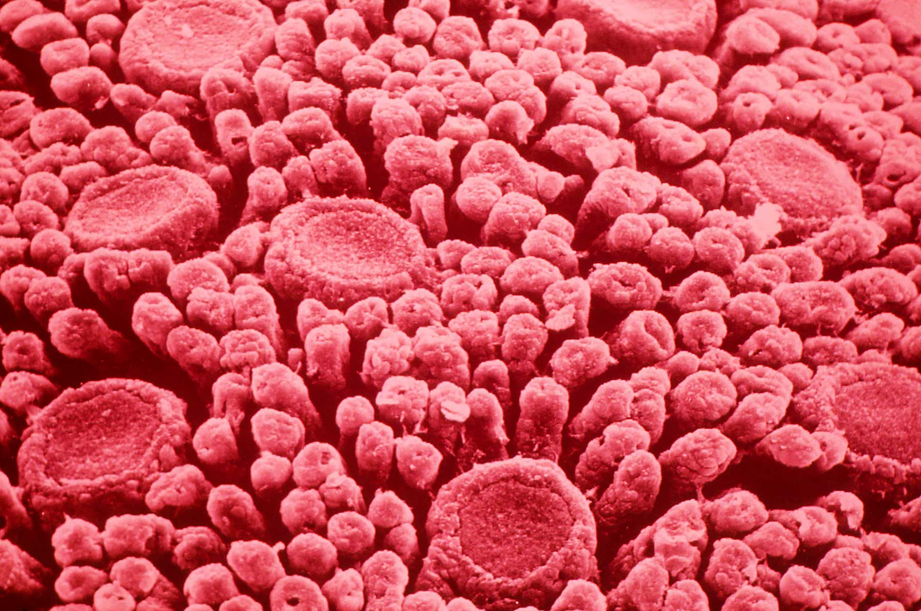 Женский сосок под микроскопом Женский сосок под микроскопом