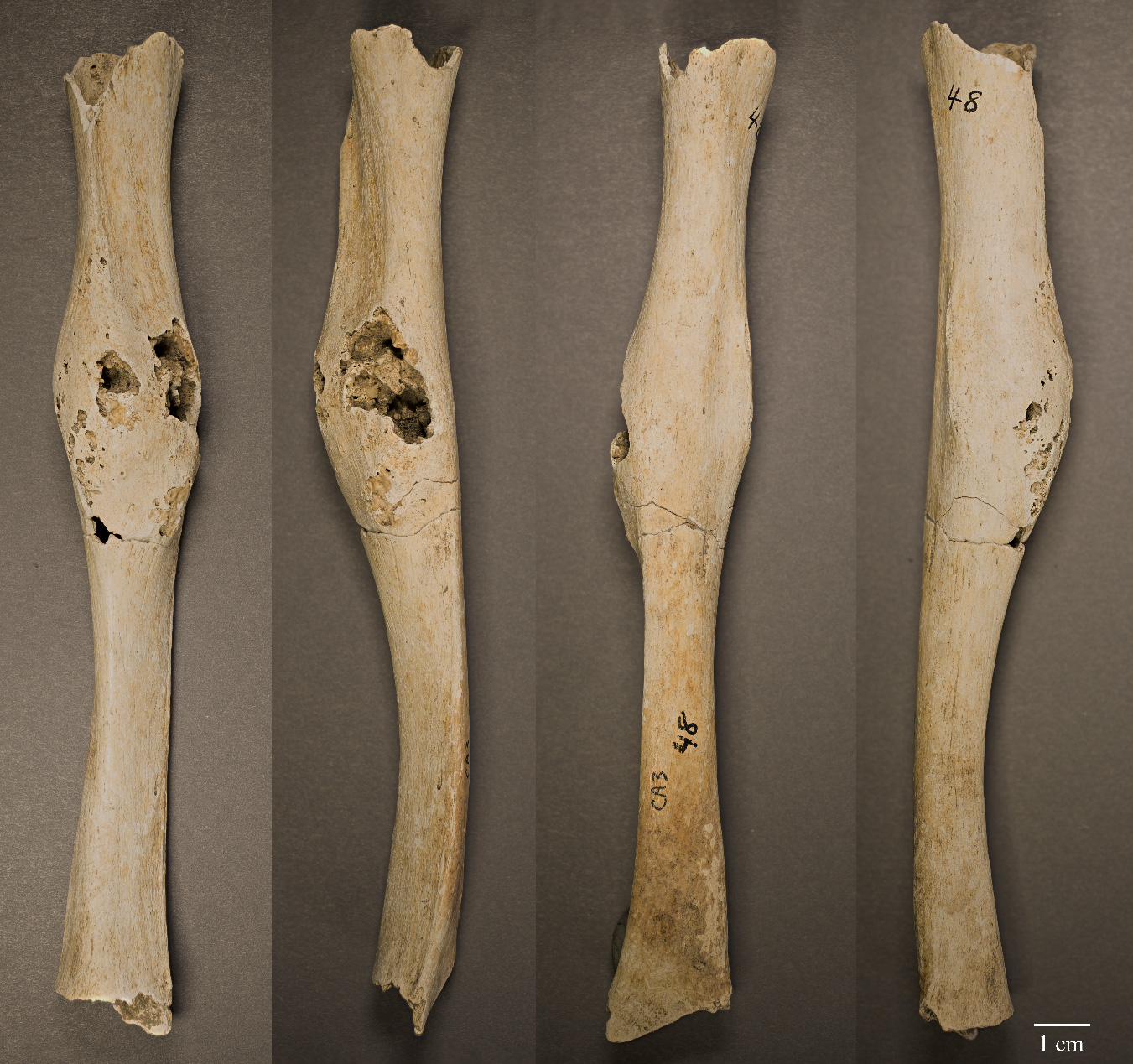 Is This the Oldest-Known Cancer Case in Central America?