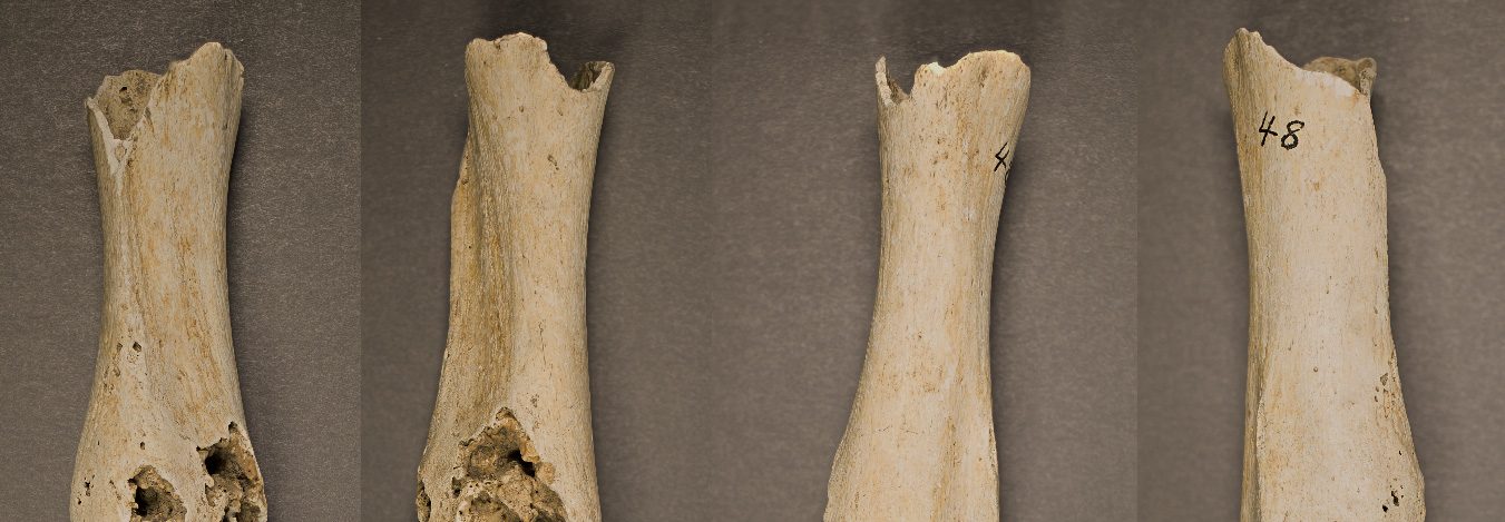 Is This Central America's Oldest-Known Cancer Case?