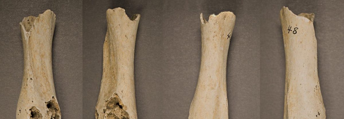 Is This Central America's Oldest-Known Cancer Case?