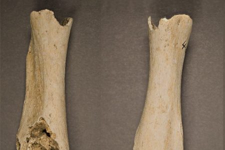Is This Central America's Oldest-Known Cancer Case?