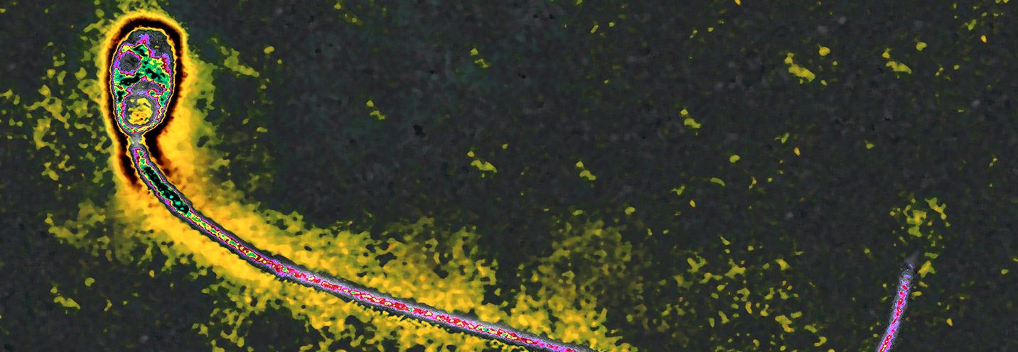 Working a Graveyard Shift Could Lower Your Sperm Count