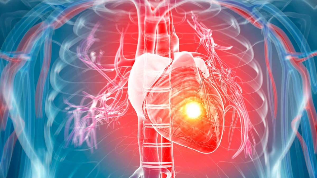 LowDose Aspirin for Heart Attack Prevention No Longer InsideHook