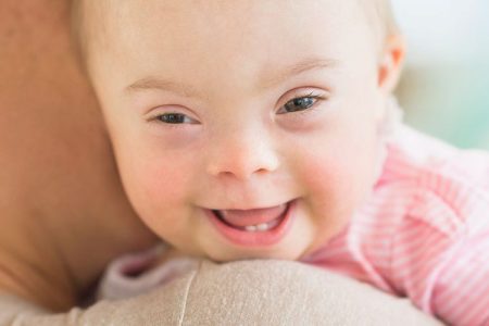 A baby girl with Down syndrome.