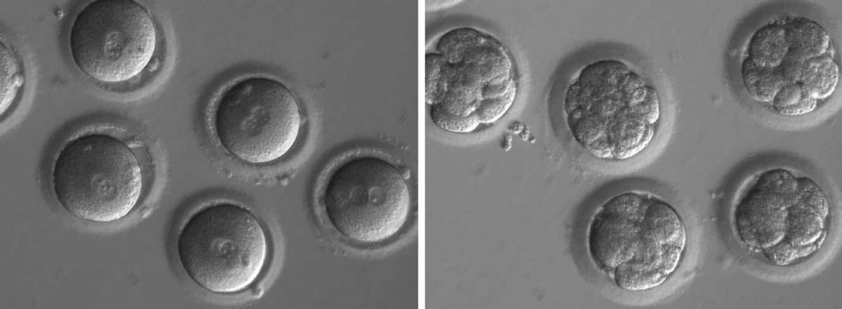 Gene Editing in Human Embryos