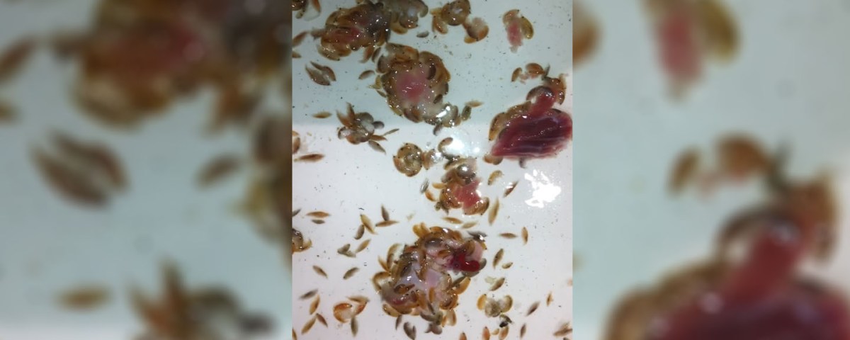 ‘Sea lice’ feast on fresh meat in Australia after teenager left bloodied. (Jarrod Kanizay/YouTube)
