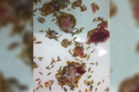‘Sea lice’ feast on fresh meat in Australia after teenager left bloodied. (Jarrod Kanizay/YouTube)
