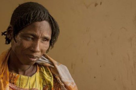 A woman receiving medical care for burns following clashes between the military and Boko Haram Islamists sits on a bed in Borno State, northeast Nigeria, on February 15, 2017. The Nigerian airforce has constructed a makeshift runway as part of military tactics to counter Boko Haram insurgency and to accelerate distribution of relief materials by donor agencies to internaly displaced people in north-eastern Nigeria, where the conflict with Boko Haram has killed at least 20,000 people and left more than 2.6 million homeless in its six-year insurgency. (AFP/FLORIAN PLAUCHEUR/Getty)