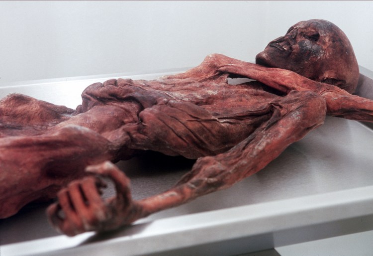 What We Can Learn About Copper Age Medicine From Otzi The Iceman's