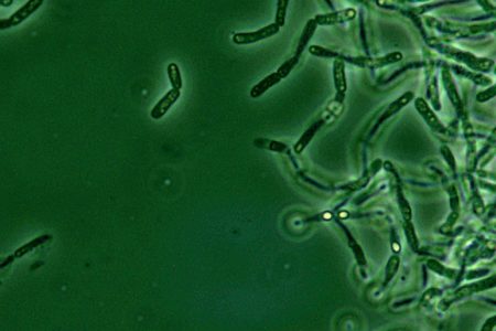 Bacillus anthracis spores seen under phase contrast microscopy. (Media for Medical/Getty Images)