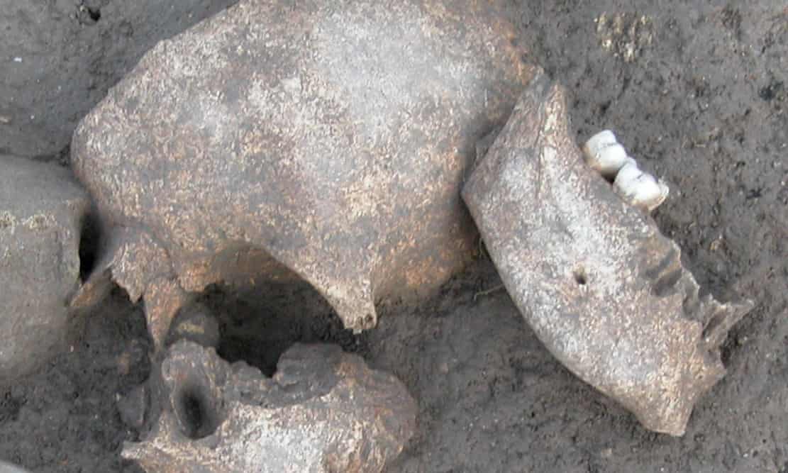  Experts found traces of conifer resins on ancient skulls at Le Cailar iron age site in France, supporting texts saying heads were embalmed. (Photograph: Handout)