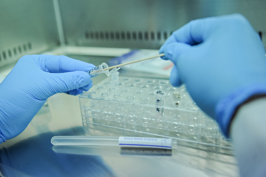 A photo taken on January 24, 2018 shows lab tecnicians demonstrating DNA testing at the Puntland Forensic Center in Garowe, Puntland State, Somalia. - The first Forensic Center in Somalia, partly funded by the Swedish government and supported by the United Nations Population Fund (UNFPA), brings advanced DNA testing capabilities to a country still lacking in paved roads and reliable electricity. The hope is that the DNA sample will help convict the woman's rapist, ushering in a new era of justice for the victims of Somalia's widespread sexual violence. (Photo by Mohamed ABDIWAHAB / AFP) (Photo credit should read MOHAMED ABDIWAHAB/AFP/Getty Images)