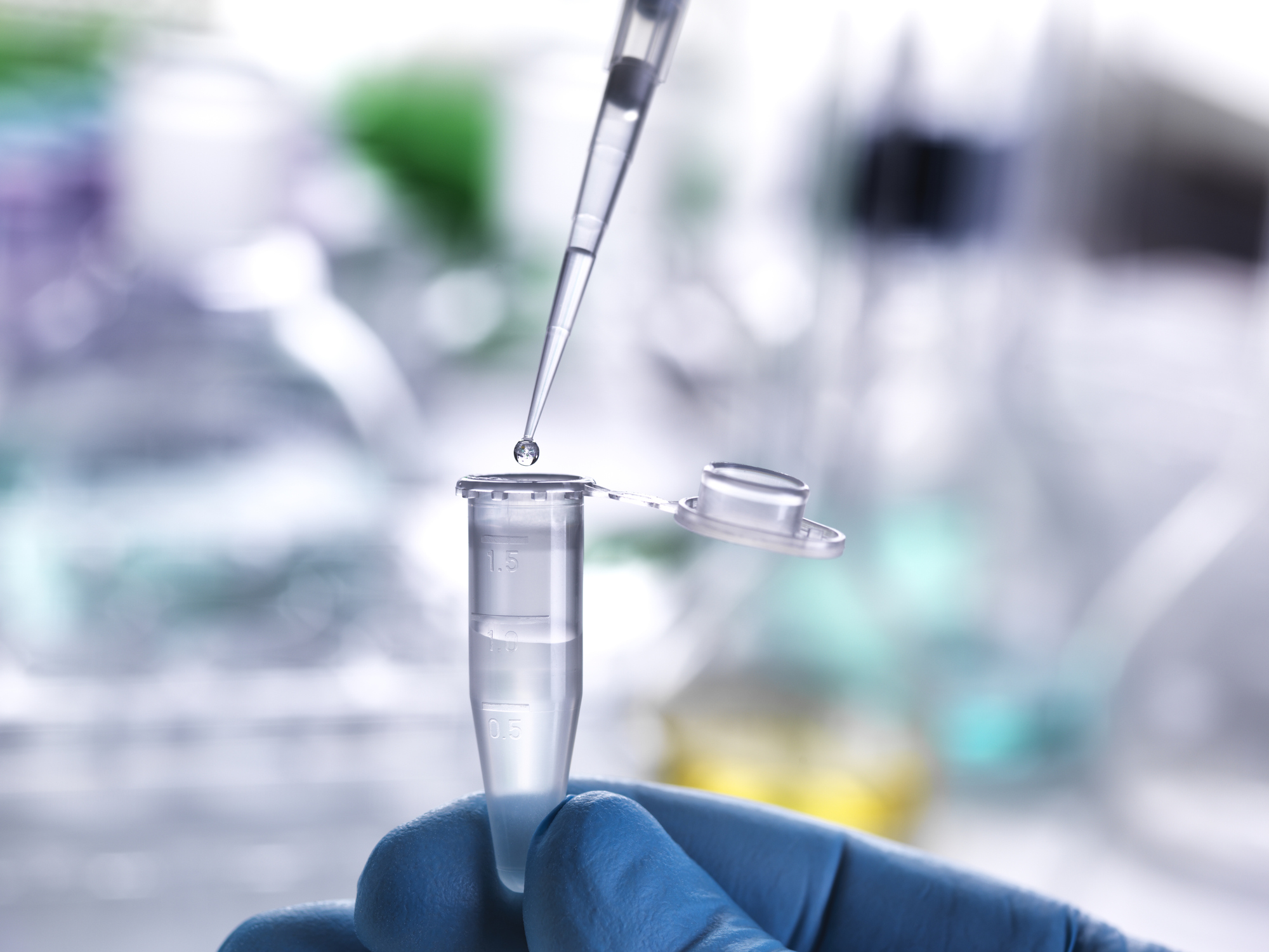 napkin DNA murder case