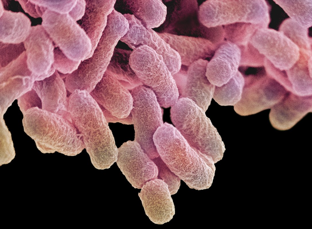 E. coli outbreak