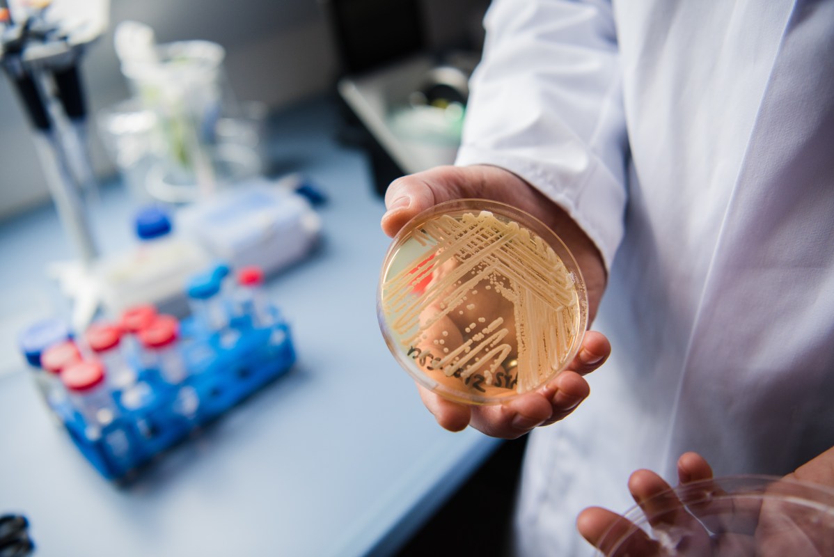 Dr. Oliver Kurzai holds a petri dish holding the yeast candida auris in a laboratory of Wuerzburg University. (Photo by Nicolas Armer/picture alliance via Getty Images)