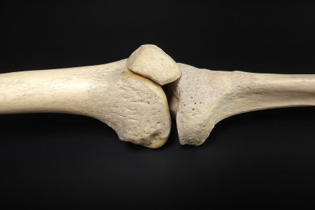 Knee bones