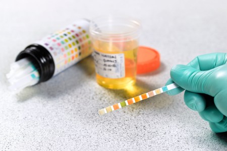 drug tests