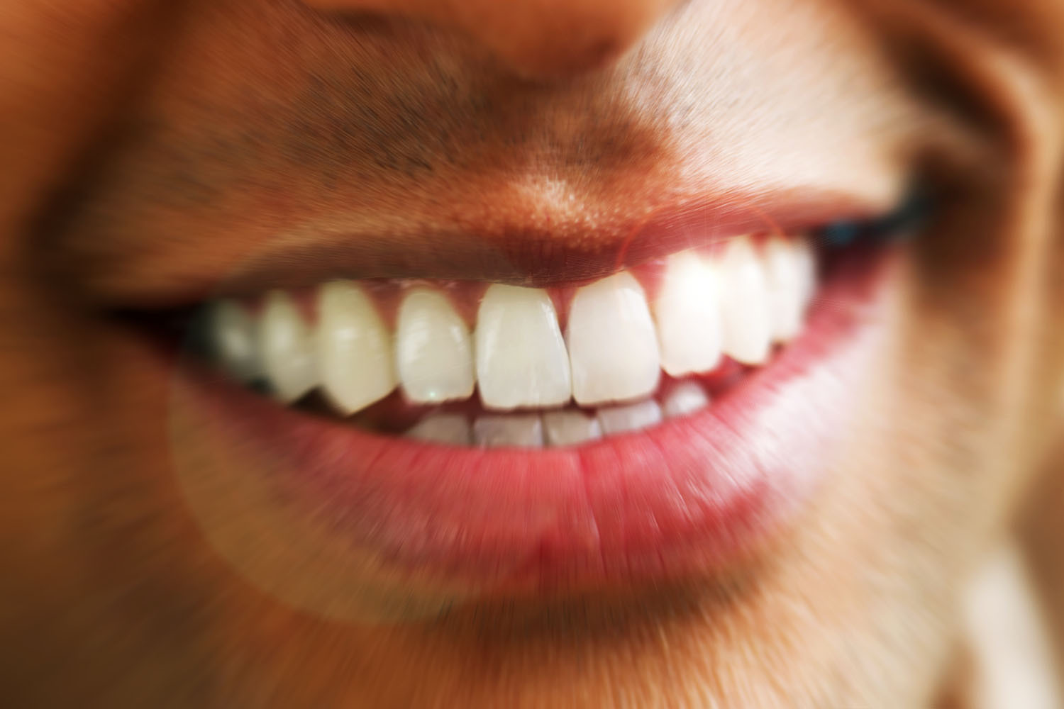 Do Any At-Home Teeth-Whitening Products Actually Work? A Dentist Weighs In.