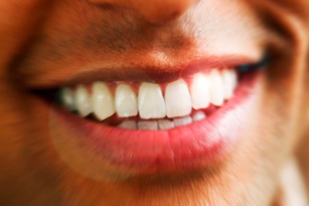 Do Any At-Home Teeth-Whitening Products Actually Work? A Dentist Weighs In.
