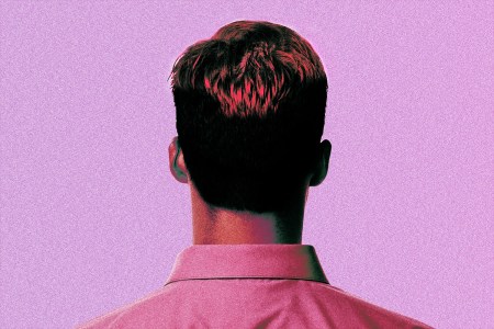 How TikTok Is Normalizing Male Hair Loss Treatments