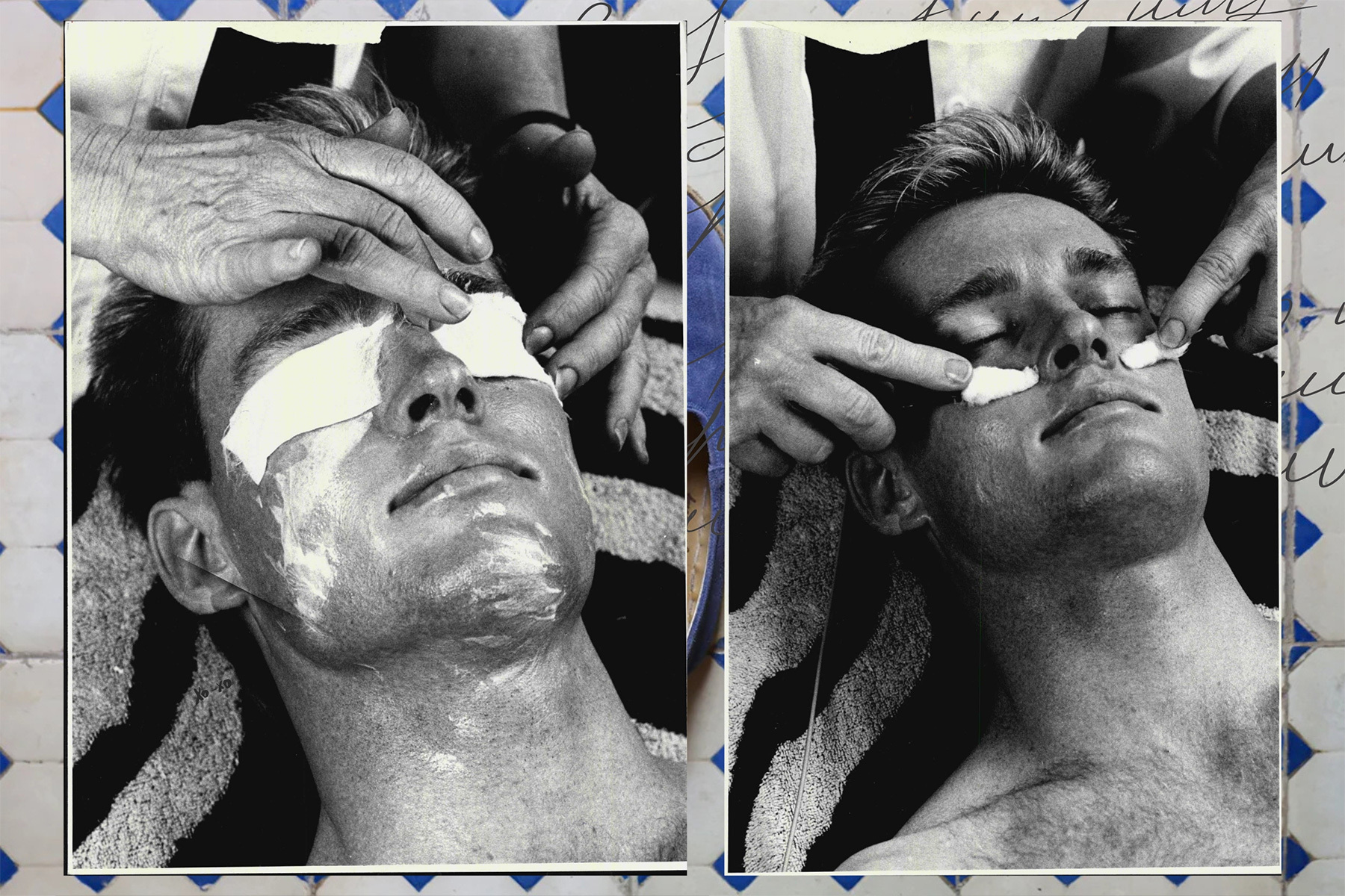 A man with lotion on his face.