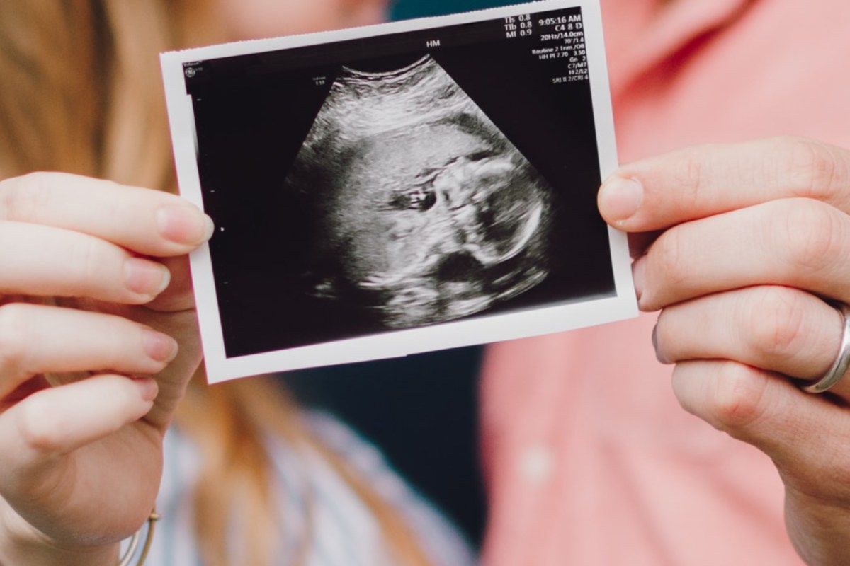 close up of couple holding an image from an ultrasound