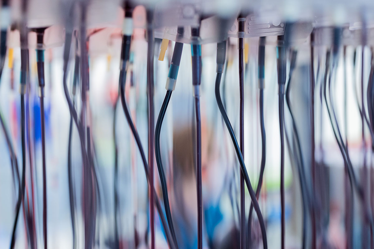 Blood transfusions in a lab. We take a look at Rh-null blood, better known as "golden blood," a rare blood type that fewer than 50 people in the world have.