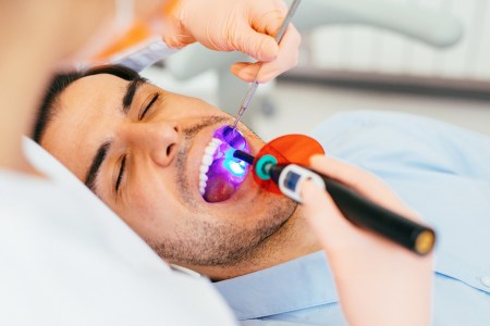 Man being treated for cavities at the dentist