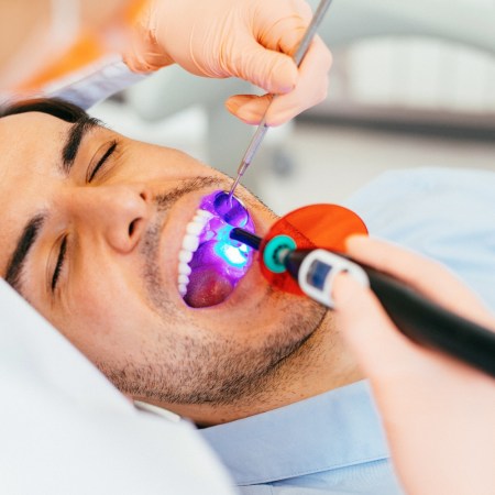 Man being treated for cavities at the dentist